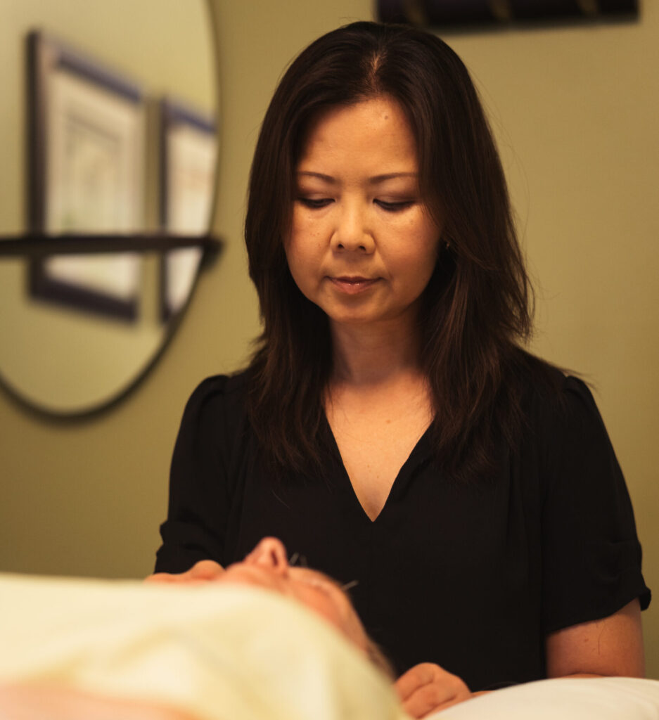 Dr. Thao Bui providing acupuncture treatment to a patient in a calm, professional clinic setting in Mississauga.