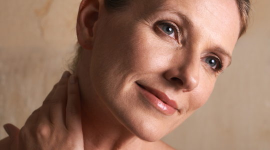 Stock photo of middle-aged woman representing cosmetic acupuncture results