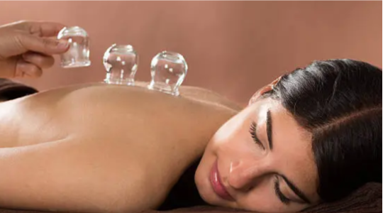 Cupping therapy on a patient’s back to improve circulation and relieve muscle tension