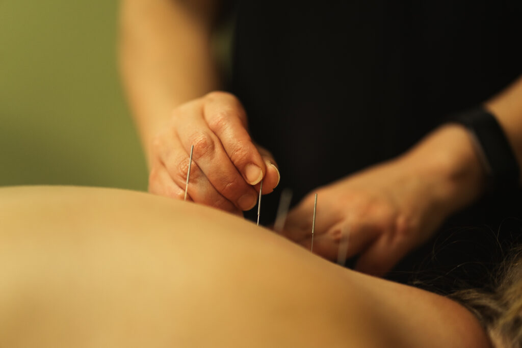 Patient lying prone while Dr. Thao places sterile needles along the lower back